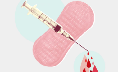 Ndryshime të ciklit menstrual pas vaksinës së Covid-19: Çfarë dihet deri tani
