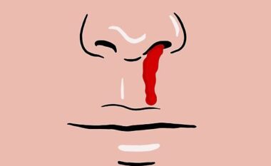 A është gjakderdhja nga hunda një simptomë e Covid?