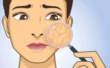 2 trajtime 100% natyrale që ushqejnë dhe hidratojnë lëkurën e thatë të fytyrës pas dushit