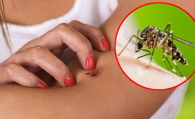 Mos u vini faj! 5 arsye pse ju pickojnë mushkonjat