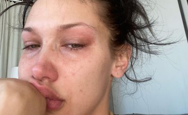 Bella Hadid: Ju që luftoni çdo ditë me ankthin, nuk jeni vetëm