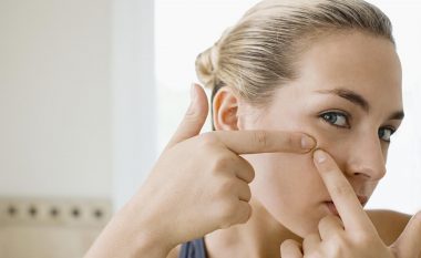 Duhet të rezistoni, dermatologët paralajmërojnë rrezik nëse shtrydhni puçrrat në këtë pjesë të fytyrës
