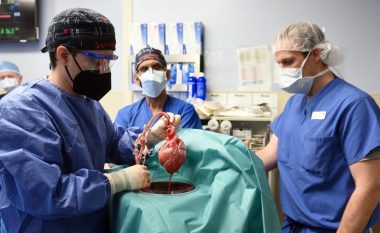 Tre çështje etike rreth transplantimit të zemrës së derrit, mes tyre dhe feja