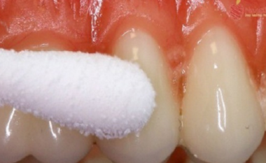 Truku që dentistët e mbajnë sekret, si të ndaloni dhimbjen e dhëmbit në pak sekonda