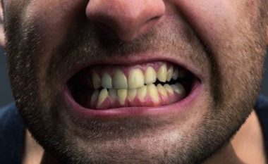 Hiqni dorë nga këto zakone të përditshme, po u dëmtojnë dhe zverdhin dhëmbët