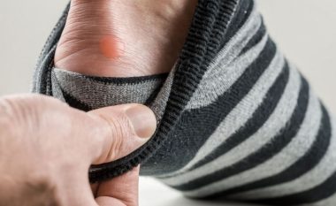 3 metoda natyrale, si t’i shëroni flluskat e këmbës brenda natës