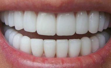Bëni dhëmbët e bardhë në shtëpi për vetëm 3 minuta, ndiqni këto rregulla të arta