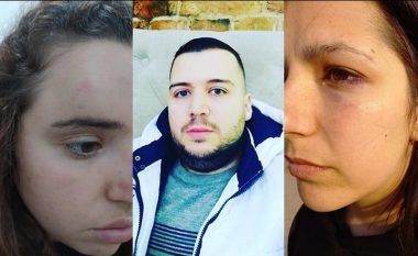 “Na zuri pritë për herë të dytë”, flet vajza që u dhunua me të motrën në Tiranë: Po bënim pazar kur na sulmoi