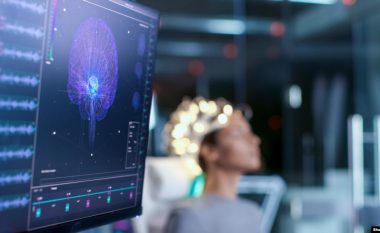 Shkencëtarët: Pacientët e prekur nga Covid-19 kanë probleme në tru për vite me radhë
