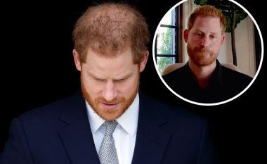 Të gjithë flasin për rënien e flokëve të tij, Prince Harry: Jam i dënuar