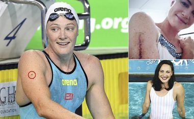 “Një kontroll i thjeshtë më shpëtoi”, notarja olimpike rrëfen si zbuloi kancerin e lëkurës që i rrezikonte jetën