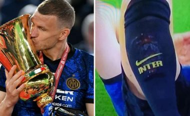 Misteri i këmbëve të Dzekos gjatë Juve-Inter: A është logoja e Romës?