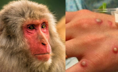 Lija e majmunit, konfirmohet rasti i parë në Rusi