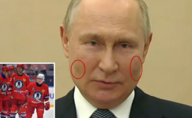 Shëndeti i Putin, presidenti rus humbet lojën e tij të preferuar, shfaqet me njolla të zeza në faqe