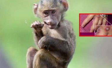 Lia e Majmunit i afrohet Shqipërisë, zbulohet rasti i parë në këtë shtet