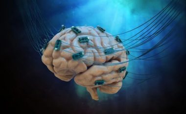 Elektroda në tru kundër depresionit, kjo metodë mund të ndihmojë në kurimin e sëmundjes në të ardhmen