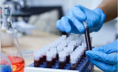 Zhvillim premtues në shkencë, testi i gjakut mund të zbulojë deri në 50 lloje kanceri në fazë të hershme