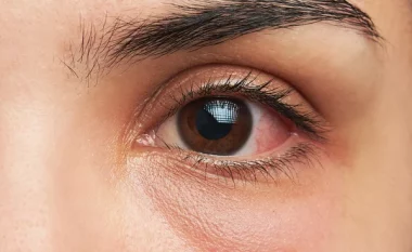 Një test i thjeshtë i syve zbulon sa gjatë do të jetoni