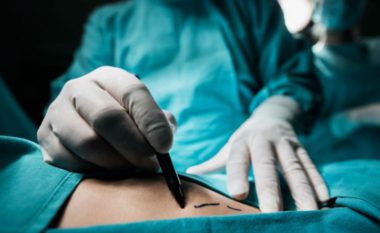 Paralajmërojnë kirurgët: Në këtë pjesë të trupit nuk duhet të bëni operacione plastike