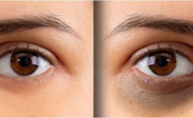 Zhdukni rrathët e syve, me këto 2 metoda do të dukeni më të reja