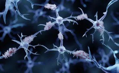 Shkencëtarët zhvillojnë një test gjaku për sëmundjen e Alzheimerit