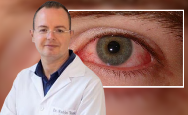 Po përhapet me shpejtësi, mjeku tregon sa janë të rrezikuar shqiptarët nga gripi i syrit