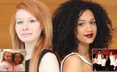 Historia e pabesueshme, motrat binjake me ngjyrë lëkure të ndryshme: Nuk na besojnë që kemi lidhje gjaku (FOTO)