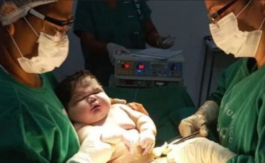 E rrallë në Brazil, lind foshnja 7.3 kg