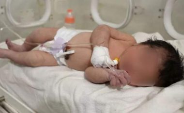 Lindi nën rrënojat e tërmetit, foshnja siriane në gjendje të qëndrueshme shëndetësore