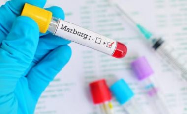 Çfarë është “Marburg”, virusi që po kërkon Afrikën