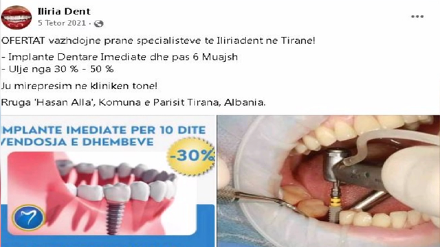 Stomatologia Gentiana Elezi e Iliria Dent premtonte dhëmbë të bardhë me ulje 50%, pacientëve u ranë