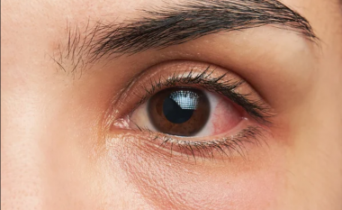 Një test i thjeshtë i syve zbulon sa gjatë do të jetoni