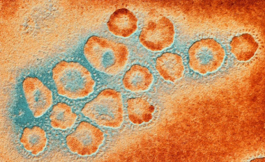 “Gripi i shpendëve ka ndryshuar”, frika e shkencëtarëve: Mund të bëhet më vdekjeprurës dhe ngjitës