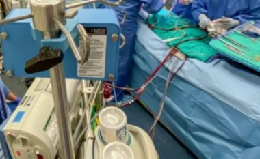 Kryhet me sukses transplanti i parë i mushkërive në botë nga roboti