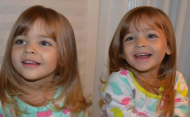 Morën titullin si “binjaket më të bukura në botë” 10 vite më parë, ja si duken ato tani