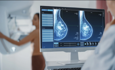 Studimi: Përdorimi i Inteligjencës Artificiale në depistimin e kancerit të gjirit, i sigurt! Bën punën e dy radiologëve