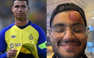 E goditi Ronaldo me top në kokë, kameramani përfundon me shenja në spital (VIDEO)