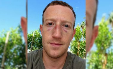 “Shkoi keq”, Mark Zuckerberg shfaqet me dy sytë e nxirë