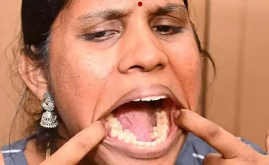 26-vjeçarja nga India me 38 dhëmbë, vendos rekord botëror Guinness