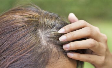 Flokë të thinjur para kohe? Rastet kur tregojnë probleme shëndetësore