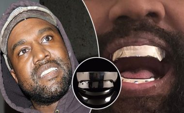 Kanye West heq të gjithë dhëmbët e tij dhe i zëvendëson me proteza titani që kushtojnë 783 mijë euro