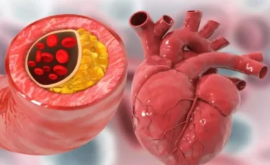 Shëndeti i zemrës/ 7 këshillat kryesore për të zhbllokuar arteriet në mënyrë natyrale dhe për të parandaluar goditjen në tru