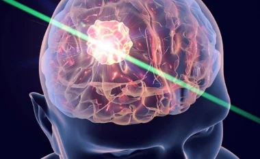 Rrit shanset për mbijetesë, zhvillohet testi i parë i gjakut në botë për tumorin në tru