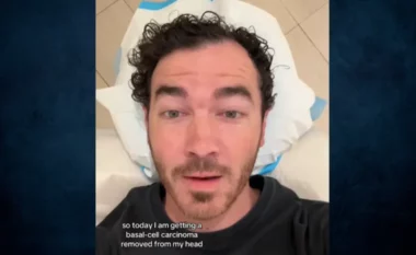 Kevin Jonas zbulon se është diagnostikuar me kancer të lëkurës