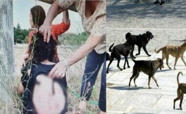 Ngjarje tronditëse/ 44-vjeçarja shqiptare sulmohet nga një tufë qensh: Ishte sikur të isha ushqimi i tyre