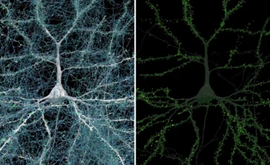 Google dhe Harvard zbulojnë hartën më të detajuar ndonjëherë të trurit të njeriut