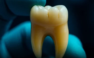 Dhëmbë të rinj nga laboratori – e ardhmja pa mbushje dentare