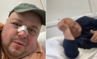 E rëndë/ Dhunohen brutalisht Genard Hajdini dhe babai i tij (VIDEO)