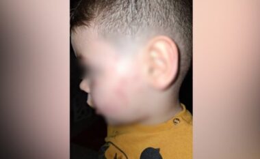 SKANDAL në Tiranë! Dhunohet nga edukatoret fëmija 3-vjeçar, drejtoresha e kopshtit “i lë” nënës Zotin: Allahu të ta marrë hakun