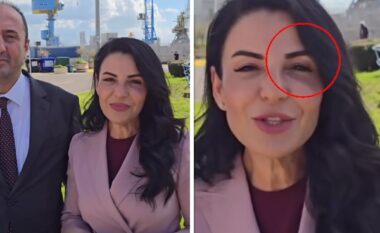 Çfarë po ndodh me Ballukun? Zëvendëskryeministrja shfaqet me sy të nxirë (FOTO+VIDEO)